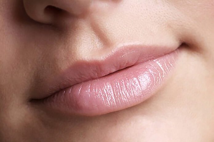 dudak morarması nasıl geçer
